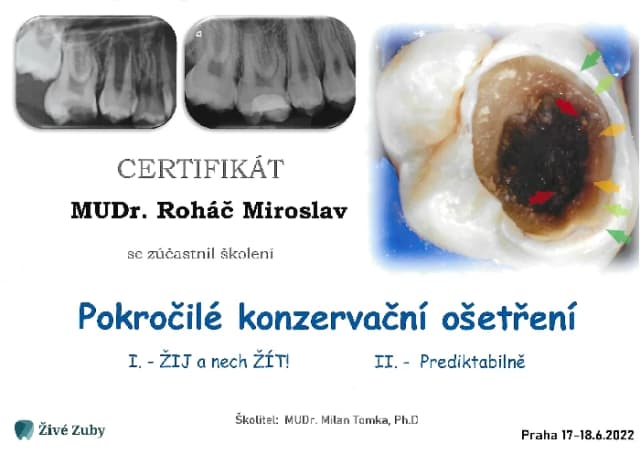 Pokročilé konzervační ošetření